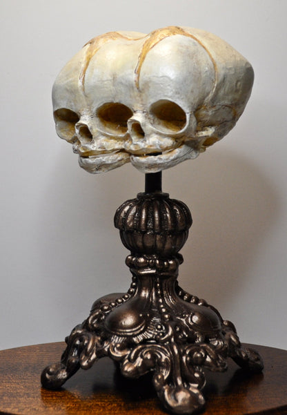 Conjoined Twins Fetal Skull Display
